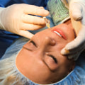 Negotiating Prices with Plastic Surgeons: Tips from an Expert