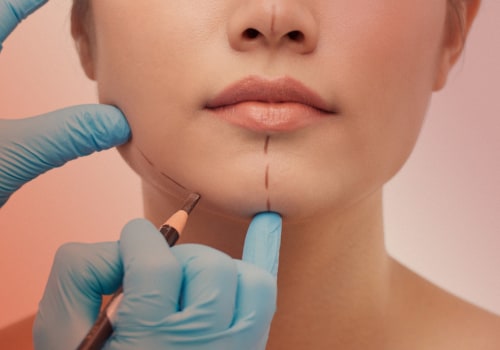 The Truth About Plastic Surgery: A Comprehensive Guide from an Expert's Perspective